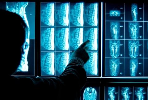 Auxiliar Obtem Equiparacao Salarial Com Tecnico Em Radiologia Mesmo Sem Habilitacao Farelos Juridicos